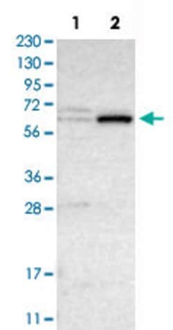 CRAT, Rabbit anti-Human, Polyclonal Antibody, Abnova 100&mu;L; Unconjugated:Antibodies,