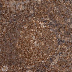 PFDN4, Rabbit anti-Human, Polyclonal Antibody, Abnova 100&mu;L; Unconjugated:Antibodies,