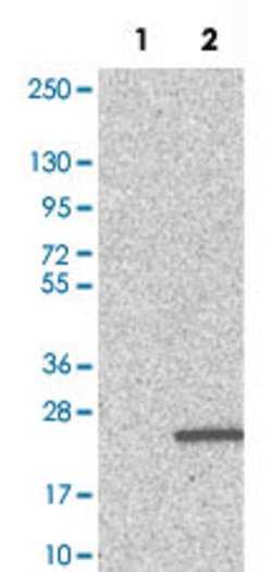 PFDN4, Rabbit anti-Human, Polyclonal Antibody, Abnova 100&mu;L; Unconjugated:Antibodies,