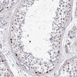 DMRT1, Rabbit anti-Human, Polyclonal Antibody, Abnova 100&mu;L; Unconjugated:Antibodies,