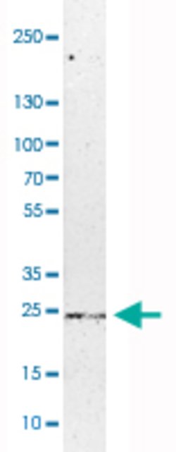 C1orf57, Rabbit anti-Human, Polyclonal Antibody, Abnova 100 &mu;L | Buy Online | Abnova | Fisher Scientific