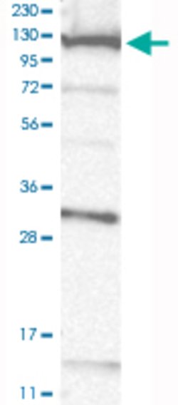 COG1, Rabbit anti-Human, Polyclonal Antibody, Abnova 100 &mu;L | Buy Online | Abnova Corporation | Fisher Scientific