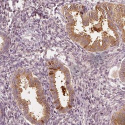 PAEP, Rabbit anti-Human, Polyclonal Antibody, Abnova 100&mu;L; Unconjugated:Antibodies,