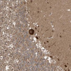 ALS2CR8, Rabbit anti-Human, Polyclonal Antibody, Abnova 100&mu;L; Unconjugated:Antibodies,