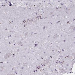 MOBP, Rabbit anti-Human, Polyclonal Antibody, Abnova 100&mu;L; Unconjugated:Antibodies,