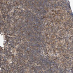 NFATC2, Rabbit anti-Human, Polyclonal Antibody, Abnova 100&mu;L; Unconjugated:Antibodies,