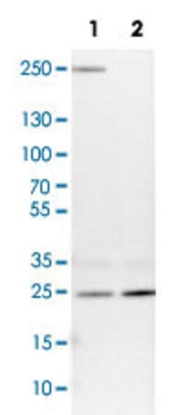 VPS28, Rabbit anti-Human, Polyclonal Antibody, Abnova 100&mu;L; Unconjugated:Antibodies,