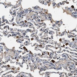 CTSB, Rabbit anti-Human, Polyclonal Antibody, Abnova 100&mu;L; Unconjugated:Antibodies,