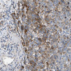 CTSB, Rabbit anti-Human, Polyclonal Antibody, Abnova 100&mu;L; Unconjugated:Antibodies,