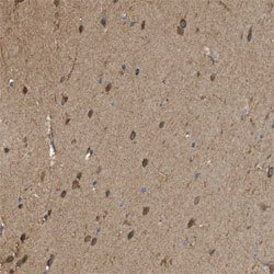 CTSB, Rabbit anti-Human, Polyclonal Antibody, Abnova 100&mu;L; Unconjugated:Antibodies,