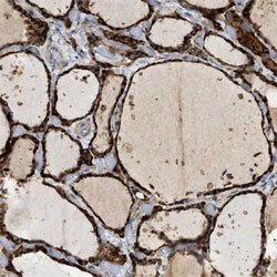 CTSB, Rabbit anti-Human, Polyclonal Antibody, Abnova 100&mu;L; Unconjugated:Antibodies,