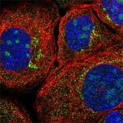 CTSB, Rabbit anti-Human, Polyclonal Antibody, Abnova 100&mu;L; Unconjugated:Antibodies,