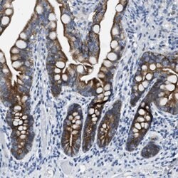 MRPL39, Rabbit anti-Human, Polyclonal Antibody, Abnova 100&mu;L; Unconjugated:Antibodies,