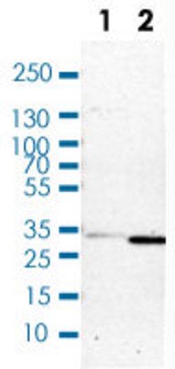 CBR1, Rabbit anti-Human, Polyclonal Antibody, Abnova 100&mu;L; Unconjugated:Antibodies,