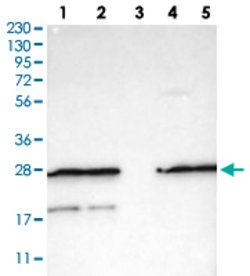 FNTA, Rabbit anti-Human, Polyclonal Antibody, Abnova 100&mu;L; Unconjugated:Antibodies,