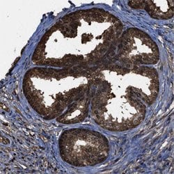 FNTA, Rabbit anti-Human, Polyclonal Antibody, Abnova 100&mu;L; Unconjugated:Antibodies,