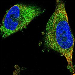 FNTA, Rabbit anti-Human, Polyclonal Antibody, Abnova 100&mu;L; Unconjugated:Antibodies,
