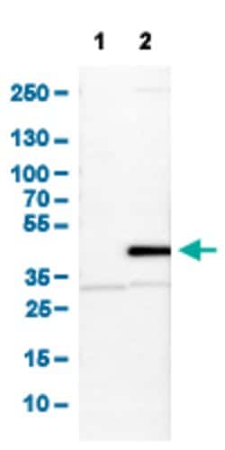 SERPINB5, Rabbit anti-Human, Polyclonal Antibody, Abnova 100&mu;L; Unconjugated:Antibodies,