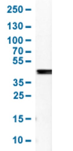 SERPINB5, Rabbit anti-Human, Polyclonal Antibody, Abnova 100&mu;L; Unconjugated:Antibodies,