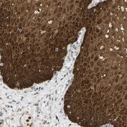 SERPINB5, Rabbit anti-Human, Polyclonal Antibody, Abnova 100&mu;L; Unconjugated:Antibodies,