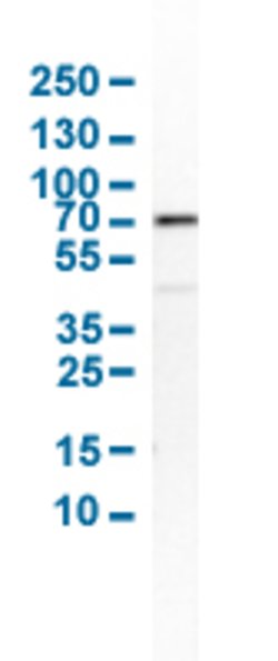 SMAD4, Rabbit anti-Human, Polyclonal Antibody, Abnova 100&mu;L; Unconjugated:Antibodies,