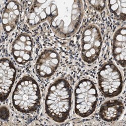 SMAD4, Rabbit anti-Human, Polyclonal Antibody, Abnova 100&mu;L; Unconjugated:Antibodies,