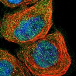 SMAD4, Rabbit anti-Human, Polyclonal Antibody, Abnova 100&mu;L; Unconjugated:Antibodies,