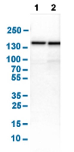 UBE4B, Rabbit anti-Human, Polyclonal Antibody, Abnova 100&mu;L; Unconjugated:Antibodies,