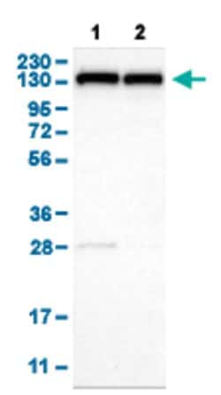 UBE4B, Rabbit anti-Human, Polyclonal Antibody, Abnova 100&mu;L; Unconjugated:Antibodies,