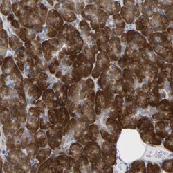 UBE4B, Rabbit anti-Human, Polyclonal Antibody, Abnova 100&mu;L; Unconjugated:Antibodies,