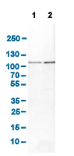 ACO1, Rabbit anti-Human, Polyclonal Antibody, Abnova 100 &mu;L | Buy Online | Abnova Corporation | Fisher Scientific