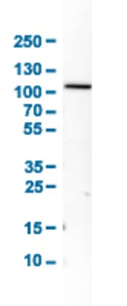 ACO1, Rabbit anti-Human, Polyclonal Antibody, Abnova 100 &mu;L | Buy Online | Abnova Corporation | Fisher Scientific