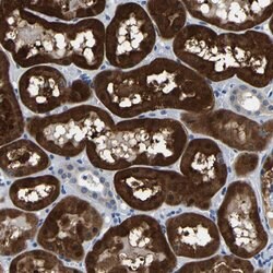 ACO1, Rabbit anti-Human, Polyclonal Antibody, Abnova 100 &mu;L | Buy Online | Abnova Corporation | Fisher Scientific