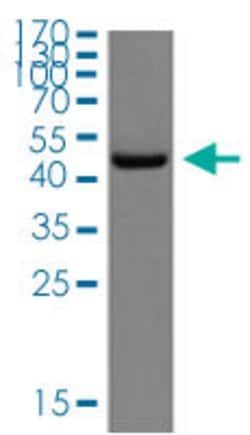 MAP2K1, Rabbit anti-Human, Polyclonal Antibody, Abnova 100&mu;L; Unconjugated:Antibodies,