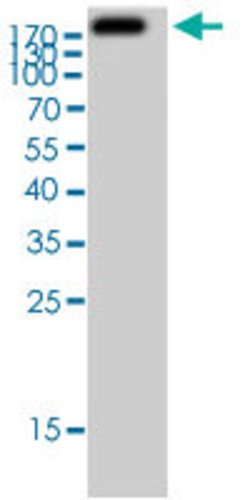 PRKD1, Rabbit anti-Human, Polyclonal Antibody, Abnova 100&mu;L; Unconjugated:Antibodies,