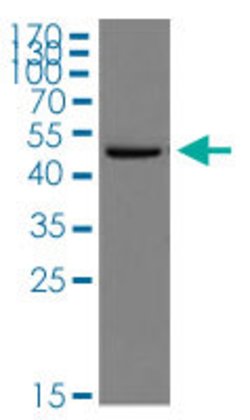 SGK1, Rabbit anti-Human, Polyclonal Antibody, Abnova 100&mu;L; Unconjugated:Antibodies,