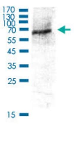 AKT1, Rabbit anti-Human, Polyclonal Antibody, Abnova 100&mu;L; Unconjugated:Antibodies,