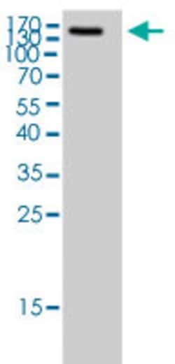 MST1R, Rabbit anti-Human, Polyclonal Antibody, Abnova 100&mu;L; Unconjugated:Antibodies,