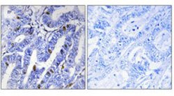 PRKAR2B, Rabbit anti-Human, Polyclonal Antibody, Abnova 100&mu;L; Unconjugated:Antibodies,