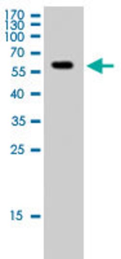 SMAD2, Rabbit anti-Human, Polyclonal Antibody, Abnova 100&mu;L; Unconjugated:Antibodies,