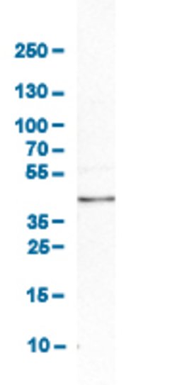 PPID, Rabbit anti-Human, Polyclonal Antibody, Abnova 100&mu;L; Unconjugated:Antibodies,