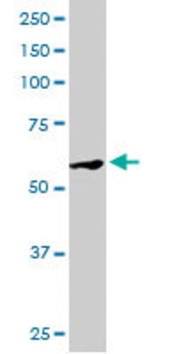 DUSP8, Goat anti-Human, Polyclonal Antibody, Abnova 100&mu;g; Unconjugated:Antibodies,