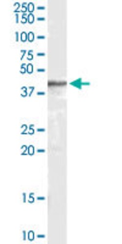 ARRB2, Goat anti-Human, Polyclonal Antibody, Abnova 100&mu;g; Unconjugated:Antibodies,