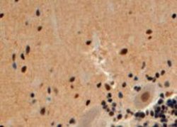 ARRB2, Goat anti-Human, Polyclonal Antibody, Abnova 100&mu;g; Unconjugated:Antibodies,