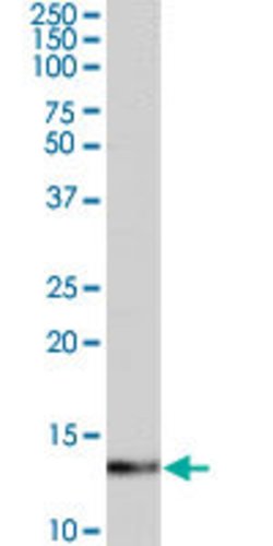 S100A4, Goat anti-Human, Polyclonal Antibody, Abnova 100&mu;g; Unconjugated:Antibodies,