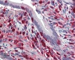 S100A4, Goat anti-Human, Polyclonal Antibody, Abnova 100&mu;g; Unconjugated:Antibodies,