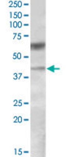 DGAT2, Goat anti-Human, Polyclonal Antibody, Abnova 100&mu;g; Unconjugated:Antibodies,
