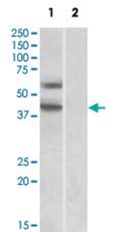 DGAT2, Goat anti-Human, Polyclonal Antibody, Abnova 100&mu;g; Unconjugated:Antibodies,