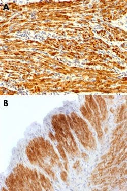 CNN1, anti-Human, Clone: CNN1/1408R, Abnova 100&mu;g; Unconjugated:Anticuerpos