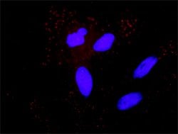 MAP3K5 APP Protein Protein Interaction Antibody Pair, Abnova 1 Set; Unconjugated:Antibodies